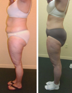 Fat loss weight loss