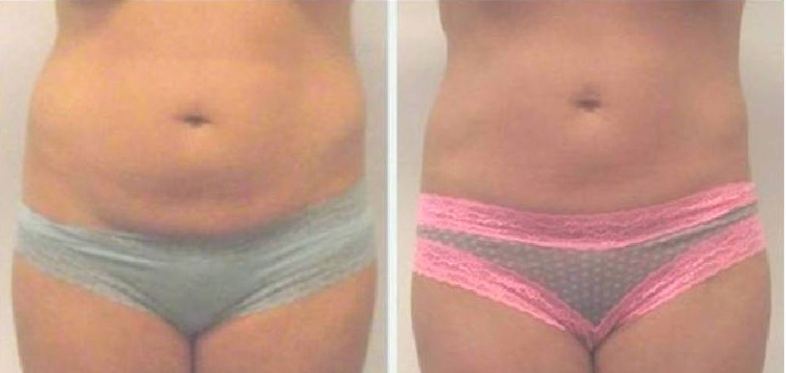 weight loss fat loss