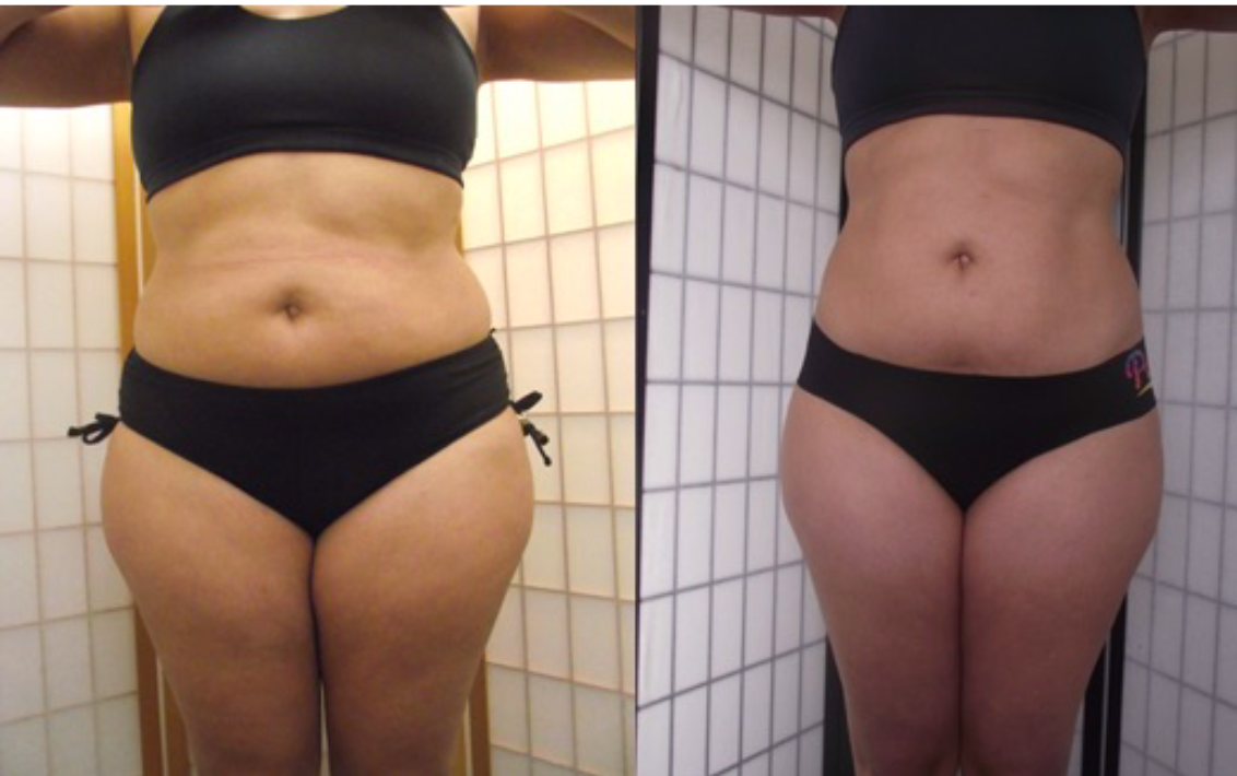 weight loss Body shaping